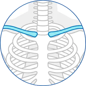 HTS Clavicular | 医療関係者向け製品| 製品情報| HOYA Technosurgical