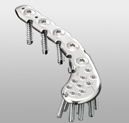 HTS Clavicular | 医療関係者向け製品| 製品情報| HOYA Technosurgical