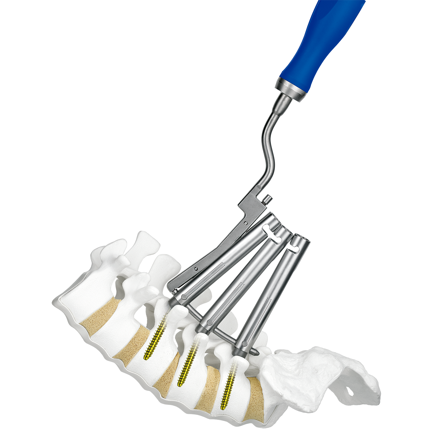 PSV | 医療関係者向け製品| 製品情報| HOYA Technosurgical 株式会社