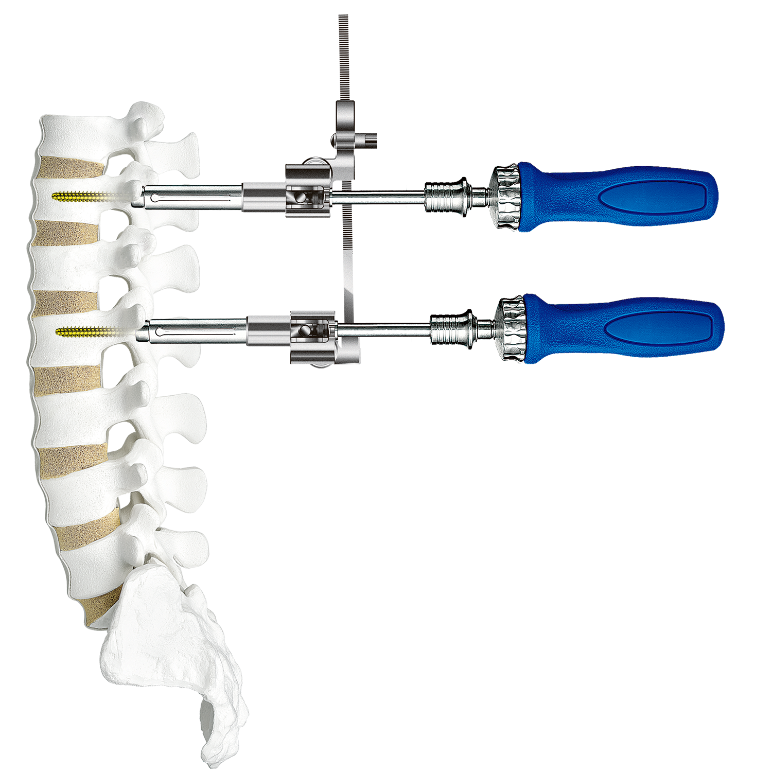 PSV | 医療関係者向け製品| 製品情報| HOYA Technosurgical 株式会社